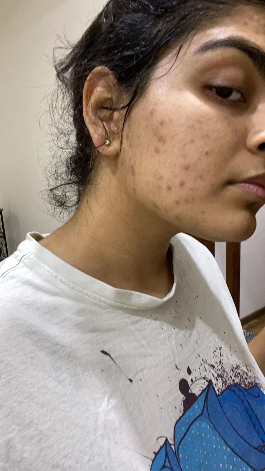 Your skin is keeping your cycle's diary.